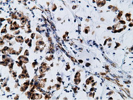 KHK Antibody in Immunohistochemistry (Paraffin) (IHC (P))