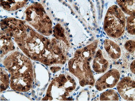 KHK Antibody in Immunohistochemistry (Paraffin) (IHC (P))