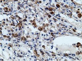 KHK Antibody in Immunohistochemistry (Paraffin) (IHC (P))