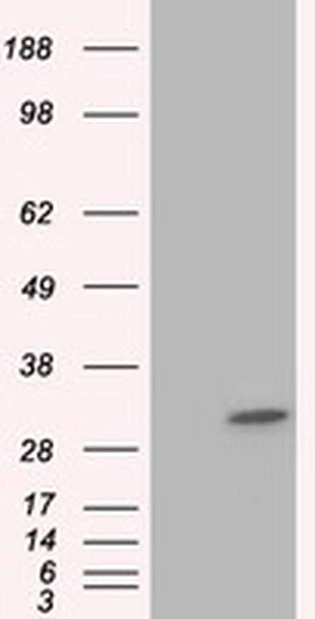 KHK Antibody in Western Blot (WB)