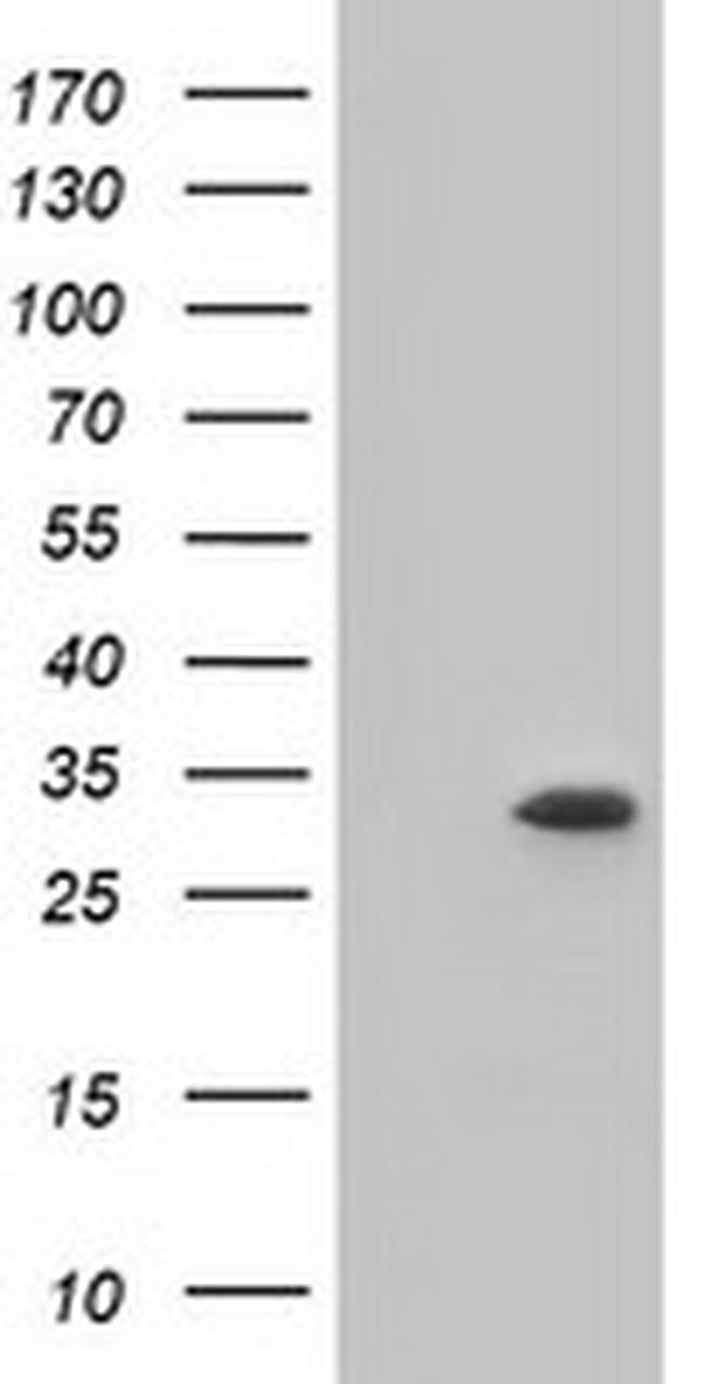 KHK Antibody in Western Blot (WB)