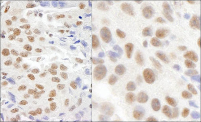 KIAA0082 Antibody in Immunohistochemistry (IHC)