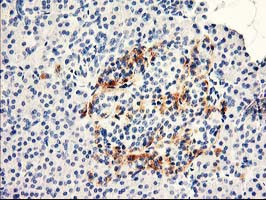 KIAA0495 Antibody in Immunohistochemistry (Paraffin) (IHC (P))