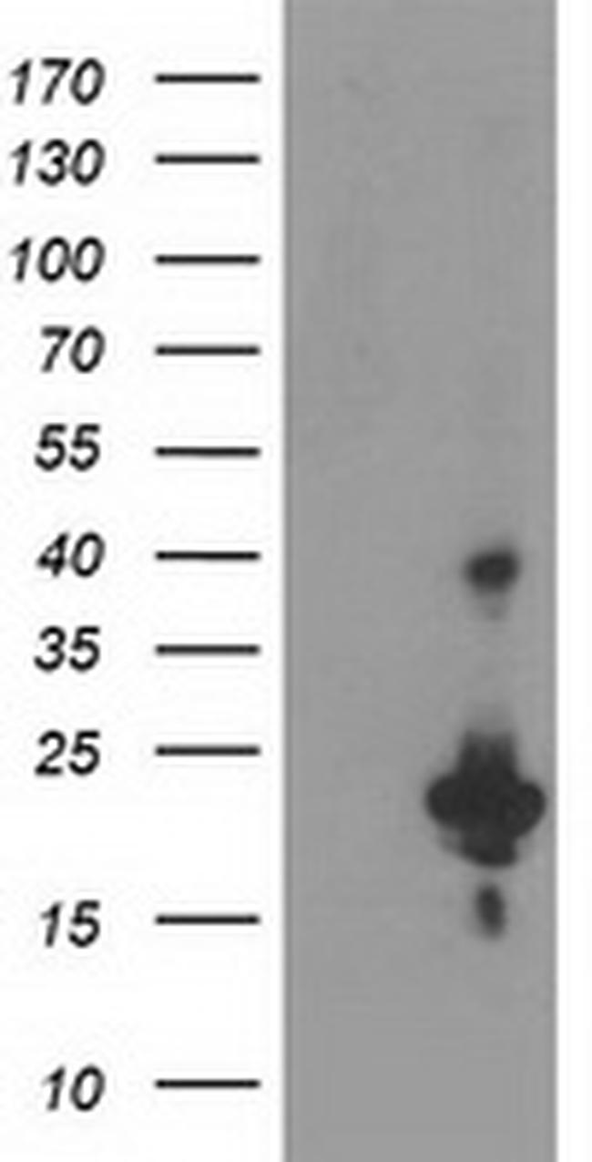 KIAA0495 Antibody in Western Blot (WB)