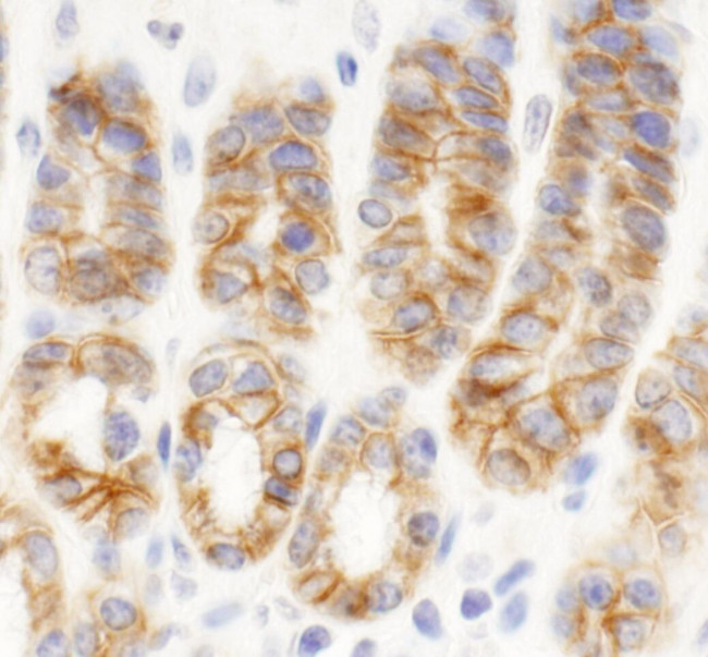 KIAA0528 Antibody in Immunohistochemistry (IHC)