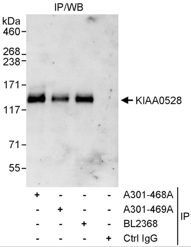 KIAA0528 Antibody in Immunoprecipitation (IP)