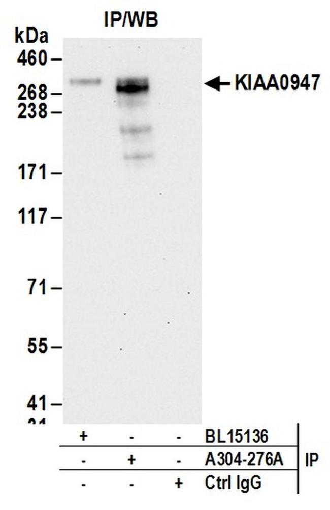 KIAA0947 Antibody in Western Blot (WB)