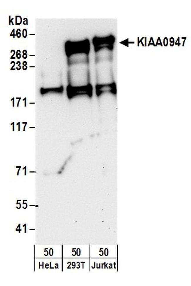 KIAA0947 Antibody in Western Blot (WB)
