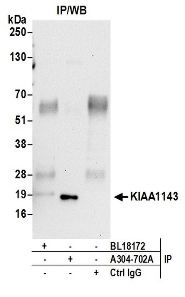 KIAA1143 Antibody in Western Blot (WB)