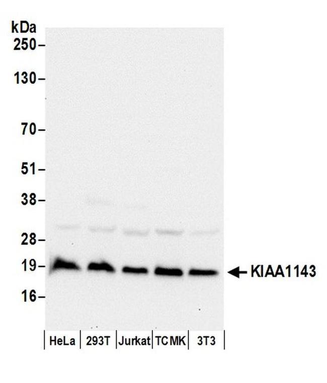 KIAA1143 Antibody in Western Blot (WB)