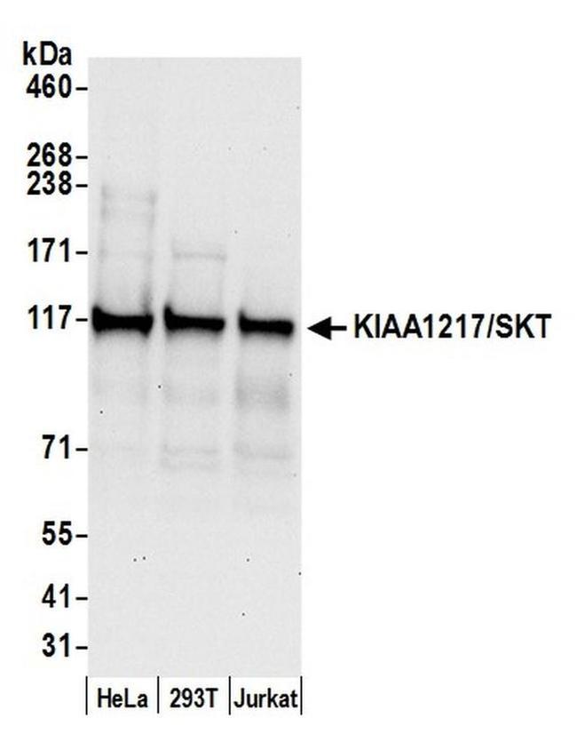 KIAA1217/SKT Antibody in Western Blot (WB)