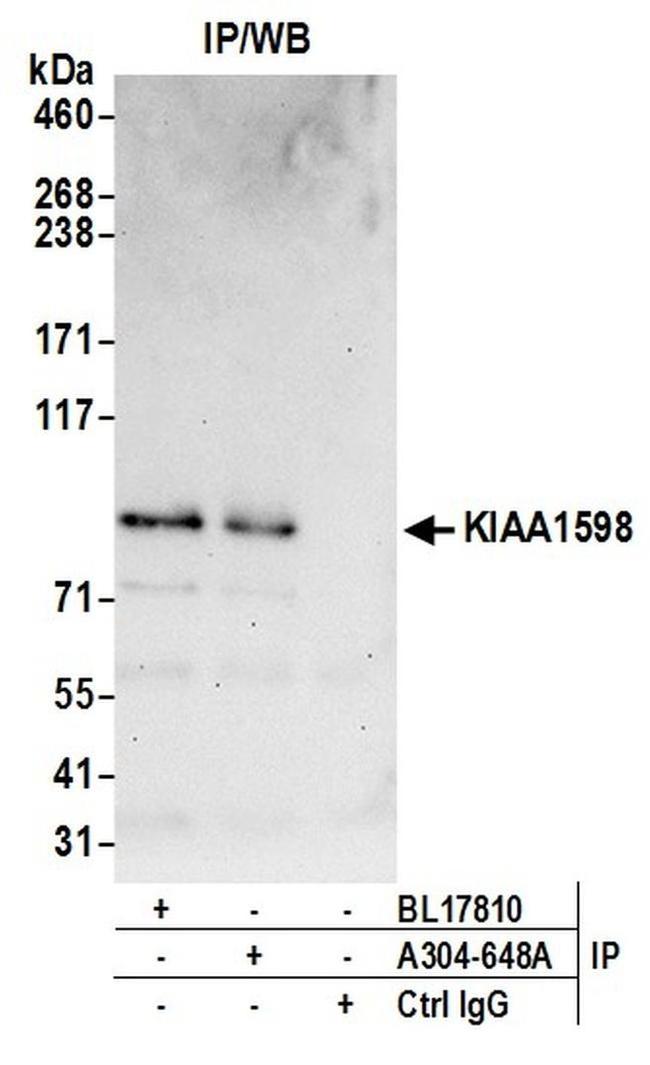 KIAA1598 Antibody in Western Blot (WB)