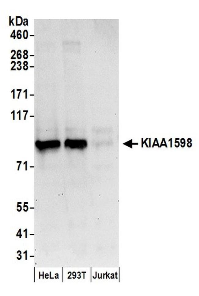 KIAA1598 Antibody in Western Blot (WB)