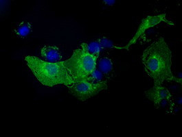 KIAA1609 Antibody in Immunocytochemistry (ICC/IF)