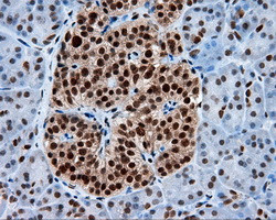 KIAA1609 Antibody in Immunohistochemistry (Paraffin) (IHC (P))