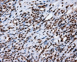 KIAA1609 Antibody in Immunohistochemistry (Paraffin) (IHC (P))