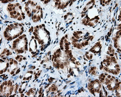 KIAA1609 Antibody in Immunohistochemistry (Paraffin) (IHC (P))