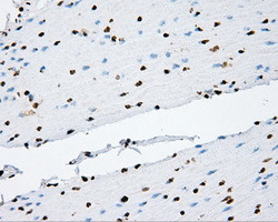 KIAA1609 Antibody in Immunohistochemistry (Paraffin) (IHC (P))