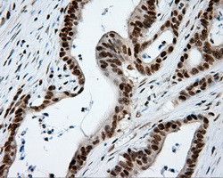 KIAA1609 Antibody in Immunohistochemistry (Paraffin) (IHC (P))