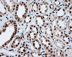 KIAA1609 Antibody in Immunohistochemistry (Paraffin) (IHC (P))