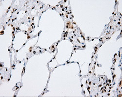 KIAA1609 Antibody in Immunohistochemistry (Paraffin) (IHC (P))