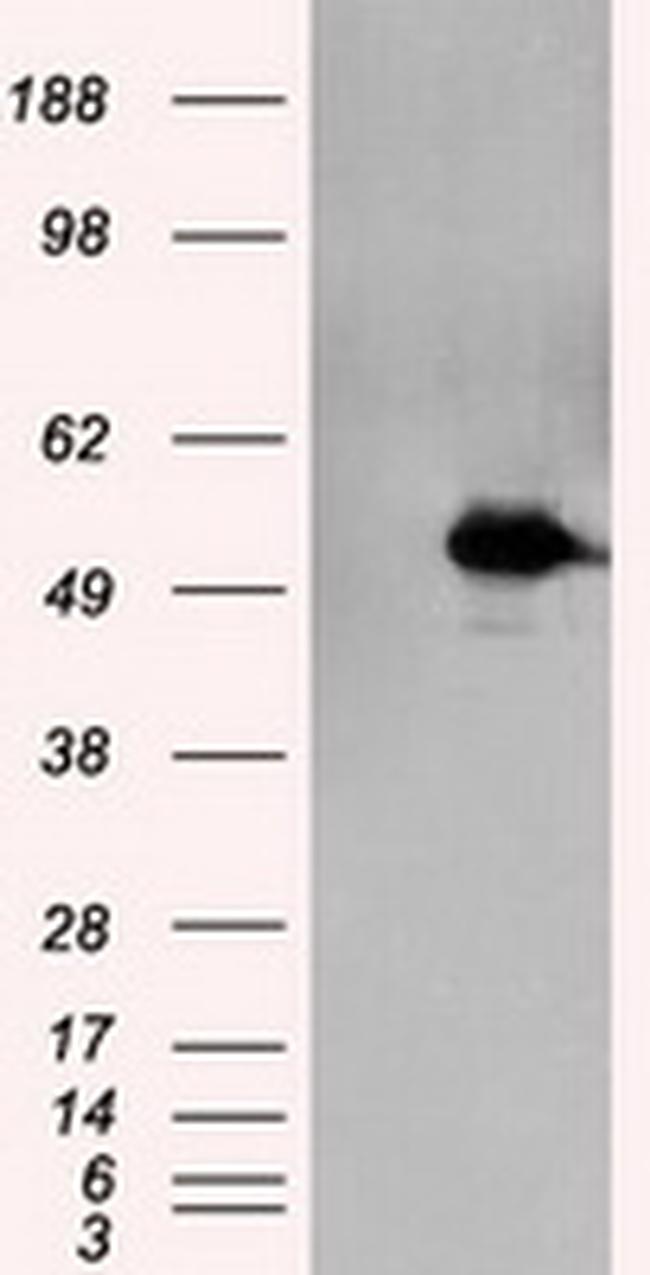 KIAA1609 Antibody in Western Blot (WB)