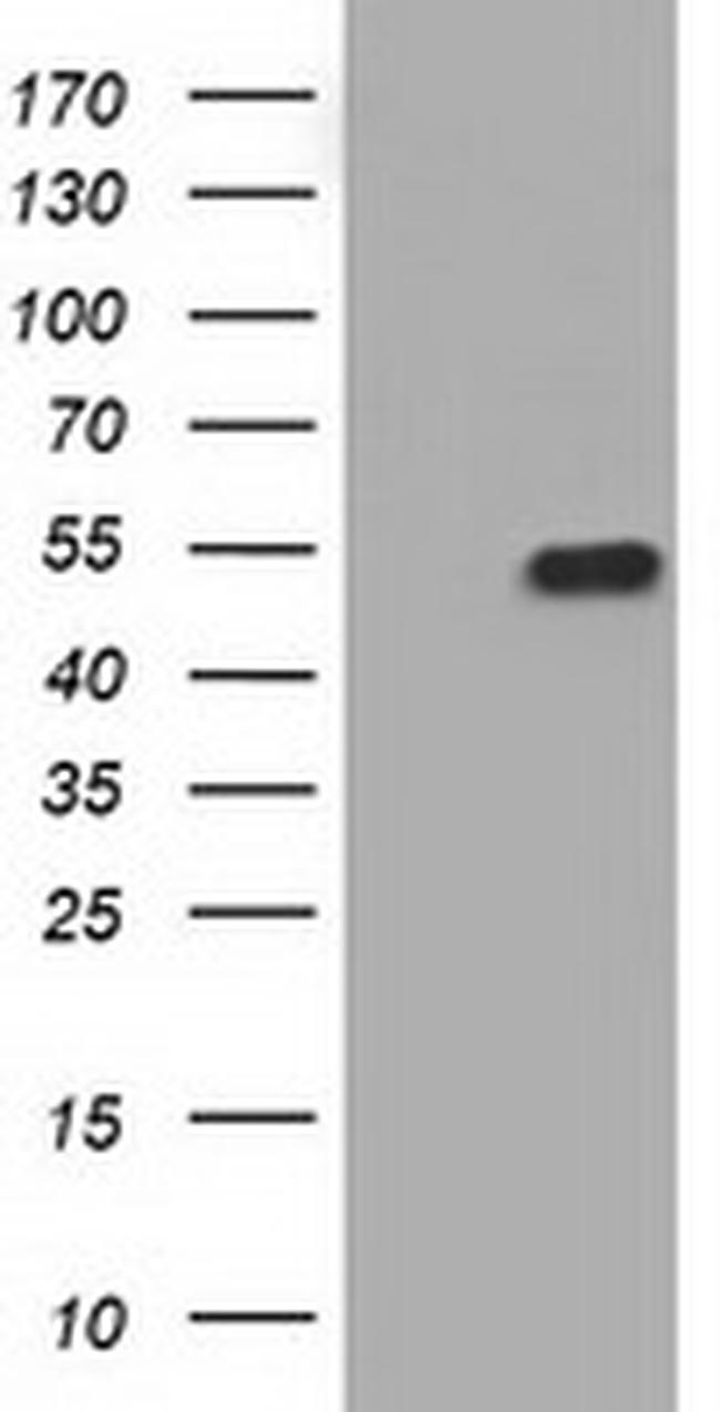 KIAA1609 Antibody in Western Blot (WB)