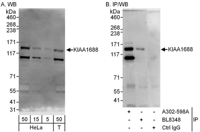 KIAA1688 Antibody in Western Blot (WB)