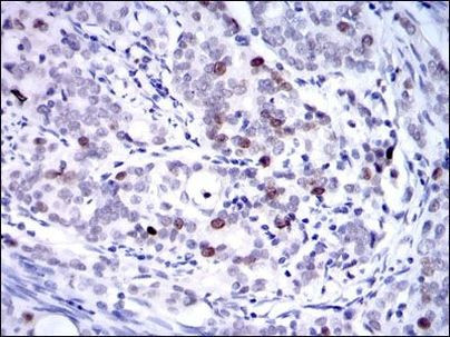 KID Antibody in Immunohistochemistry (Paraffin) (IHC (P))