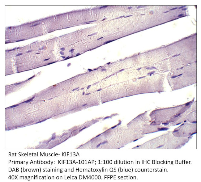 KIF13A Antibody in Immunohistochemistry (IHC)