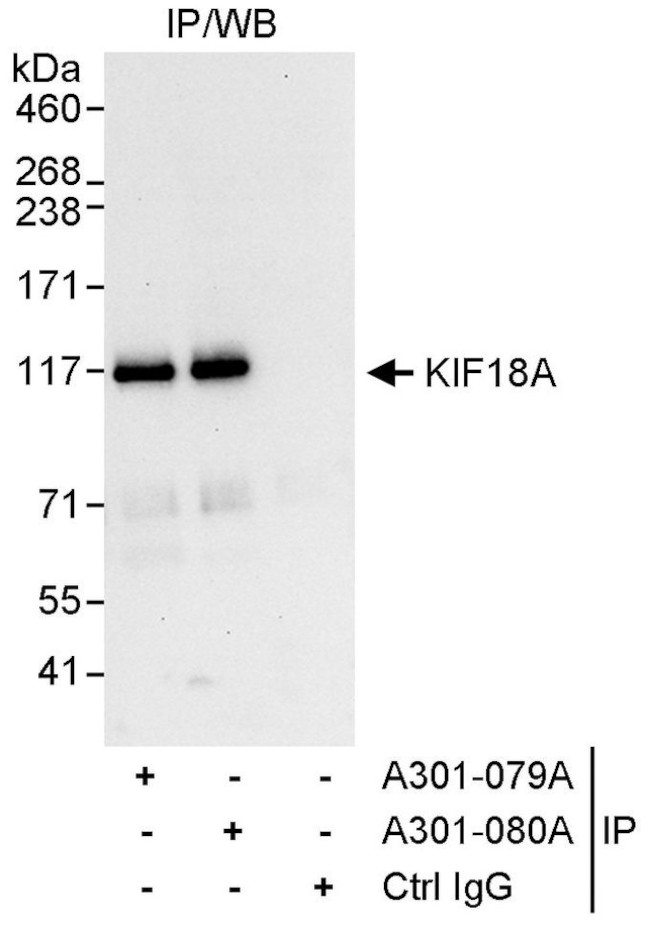 KIF18A Antibody in Immunoprecipitation (IP)