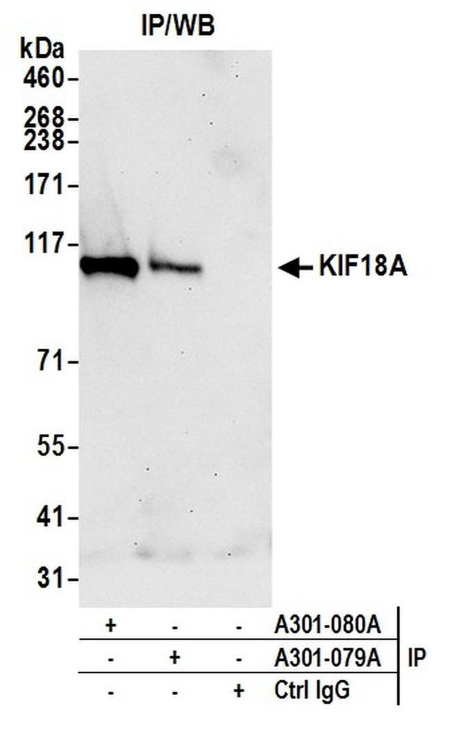 KIF18A Antibody in Western Blot (WB)