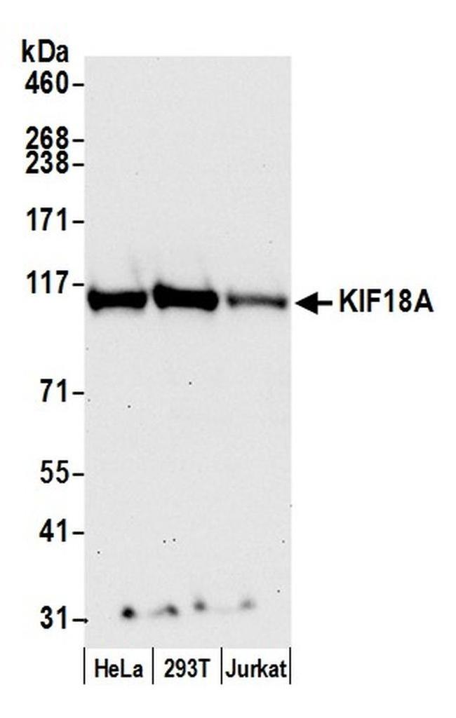 KIF18A Antibody in Western Blot (WB)