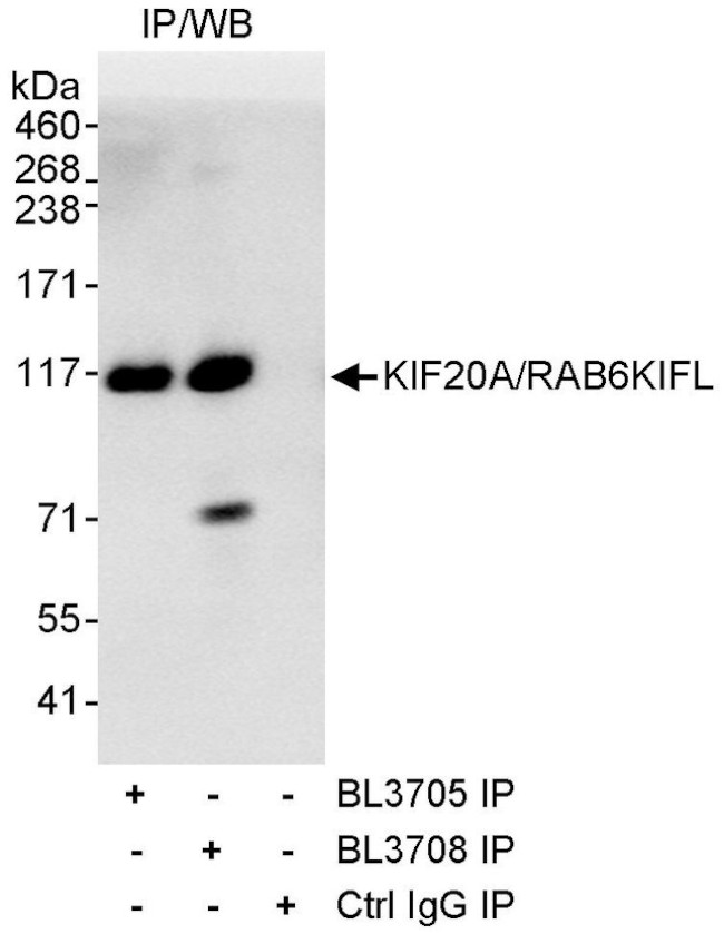 KIF20A/RAB6KIFL Antibody in Immunoprecipitation (IP)