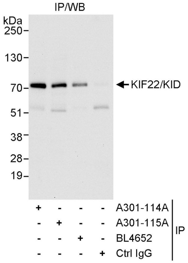 KIF22/KID Antibody in Immunoprecipitation (IP)