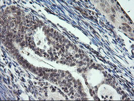 KIF25 Antibody in Immunohistochemistry (Paraffin) (IHC (P))