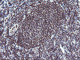 KIF25 Antibody in Immunohistochemistry (Paraffin) (IHC (P))