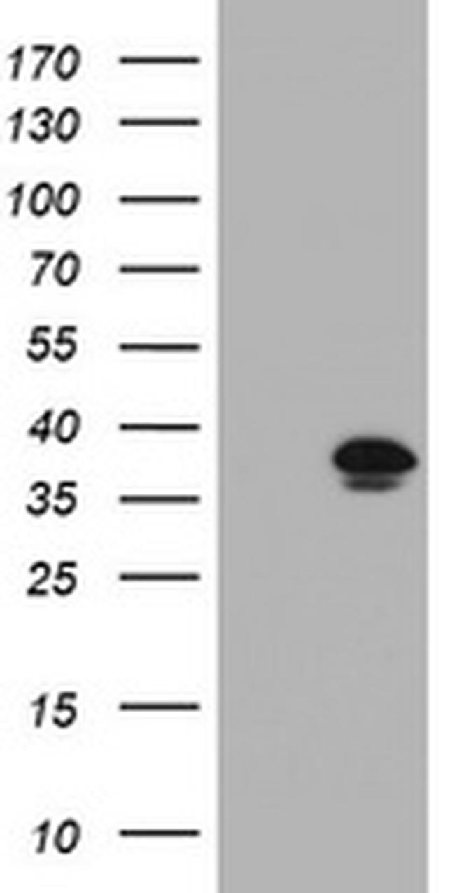 KIF25 Antibody in Western Blot (WB)