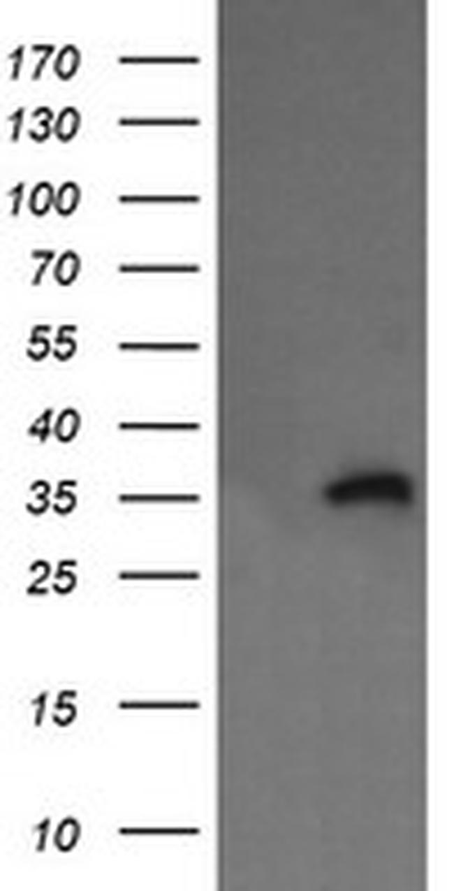 KIF25 Antibody in Western Blot (WB)