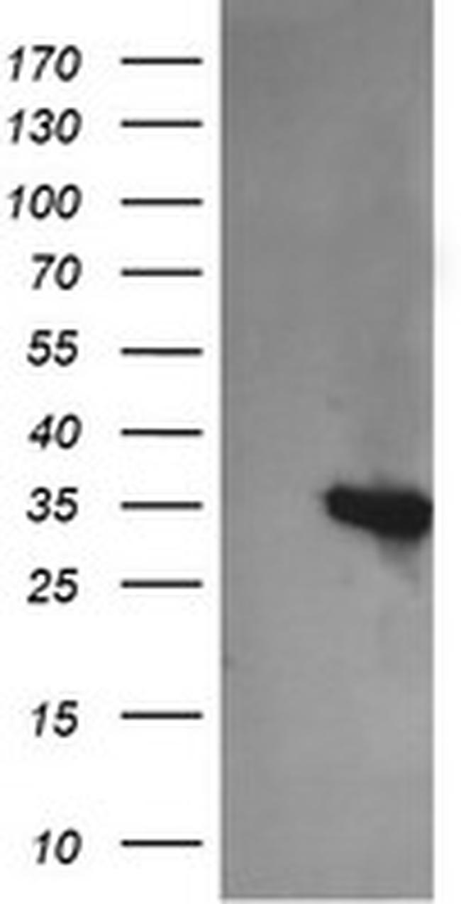 KIF25 Antibody in Western Blot (WB)