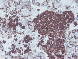 KIF2C Antibody in Immunohistochemistry (Paraffin) (IHC (P))