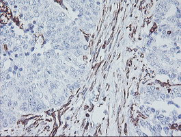 KIF2C Antibody in Immunohistochemistry (Paraffin) (IHC (P))