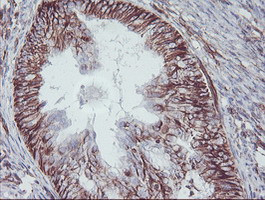 KIF2C Antibody in Immunohistochemistry (Paraffin) (IHC (P))