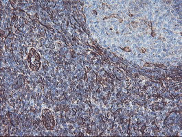 KIF2C Antibody in Immunohistochemistry (Paraffin) (IHC (P))