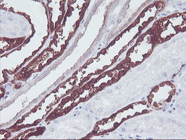 KIF2C Antibody in Immunohistochemistry (Paraffin) (IHC (P))