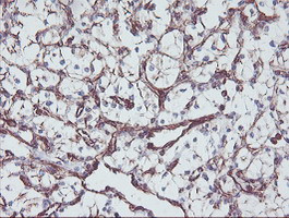 KIF2C Antibody in Immunohistochemistry (Paraffin) (IHC (P))