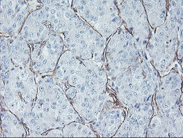 KIF2C Antibody in Immunohistochemistry (Paraffin) (IHC (P))