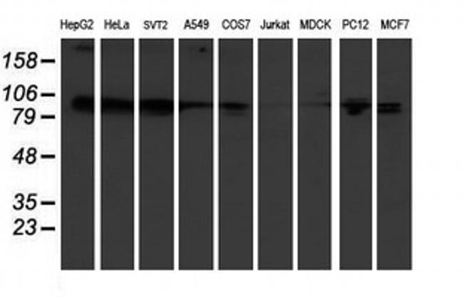 KIF2C Antibody in Western Blot (WB)