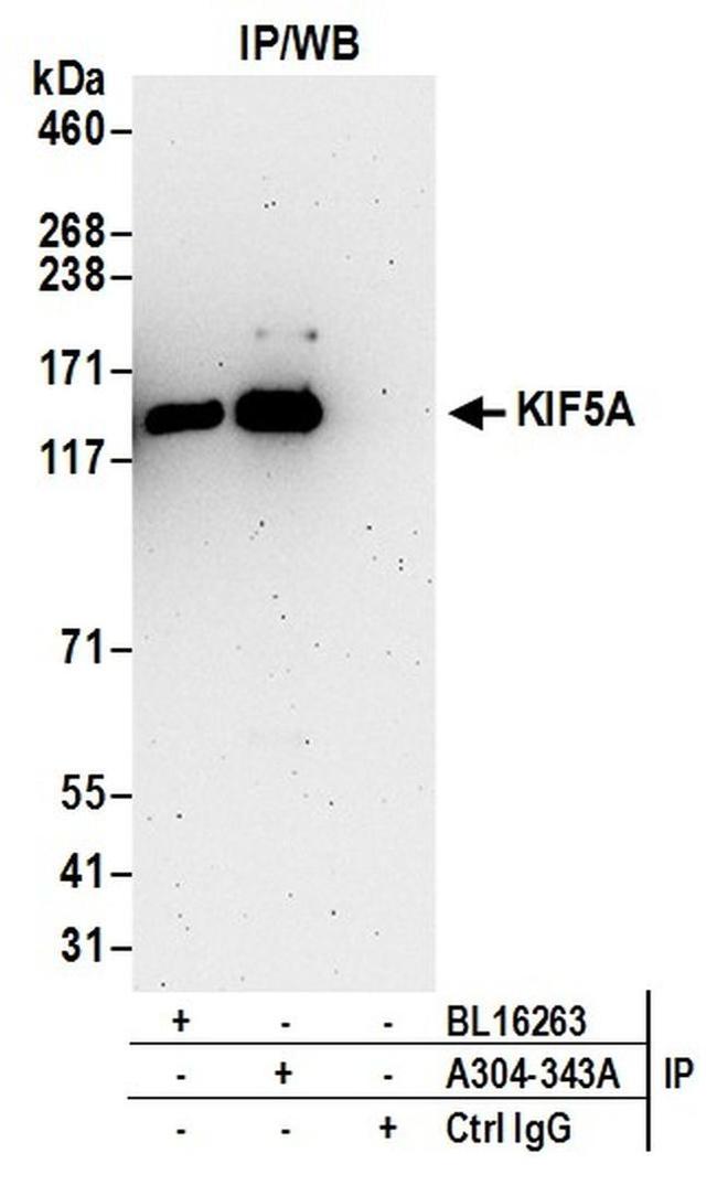 KIF5A Antibody in Western Blot (WB)