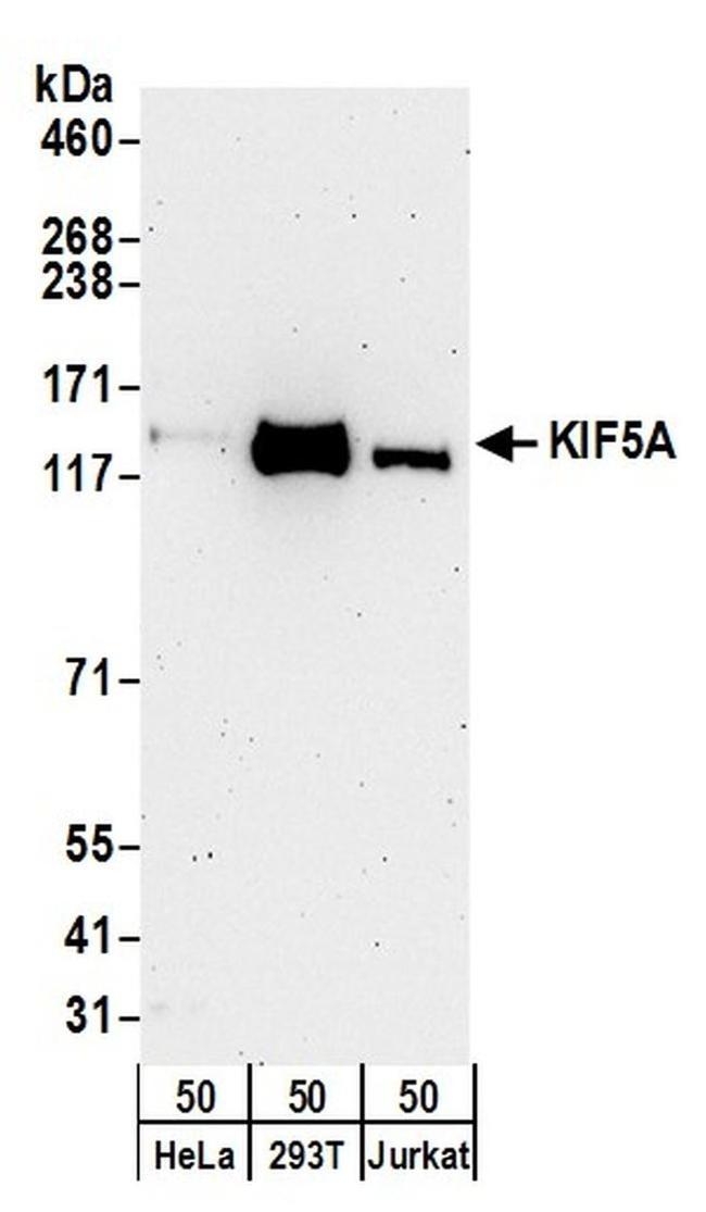 KIF5A Antibody in Western Blot (WB)